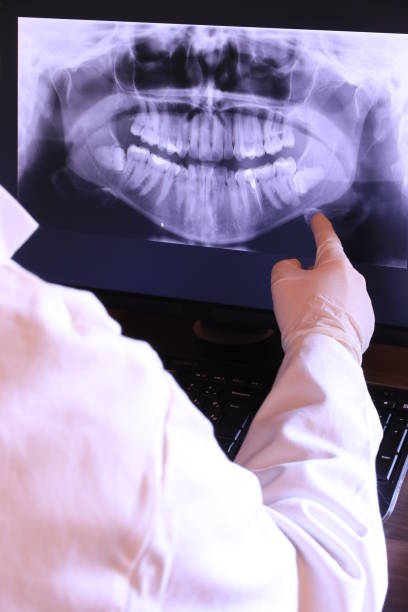 Best Emergency Root Canal Treatment in Genoa, OH